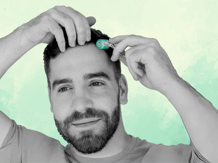 Does the derma roller work against hair loss?