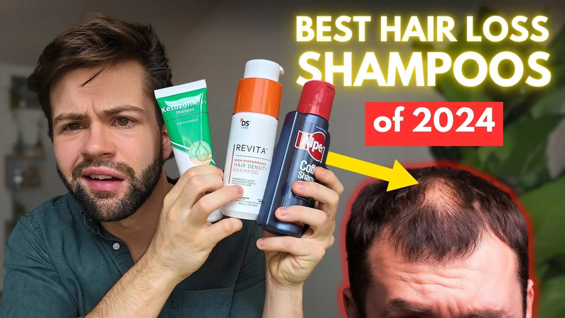 The BEST Hair Loss Shampoos I Tested in 2025: My Honest Review