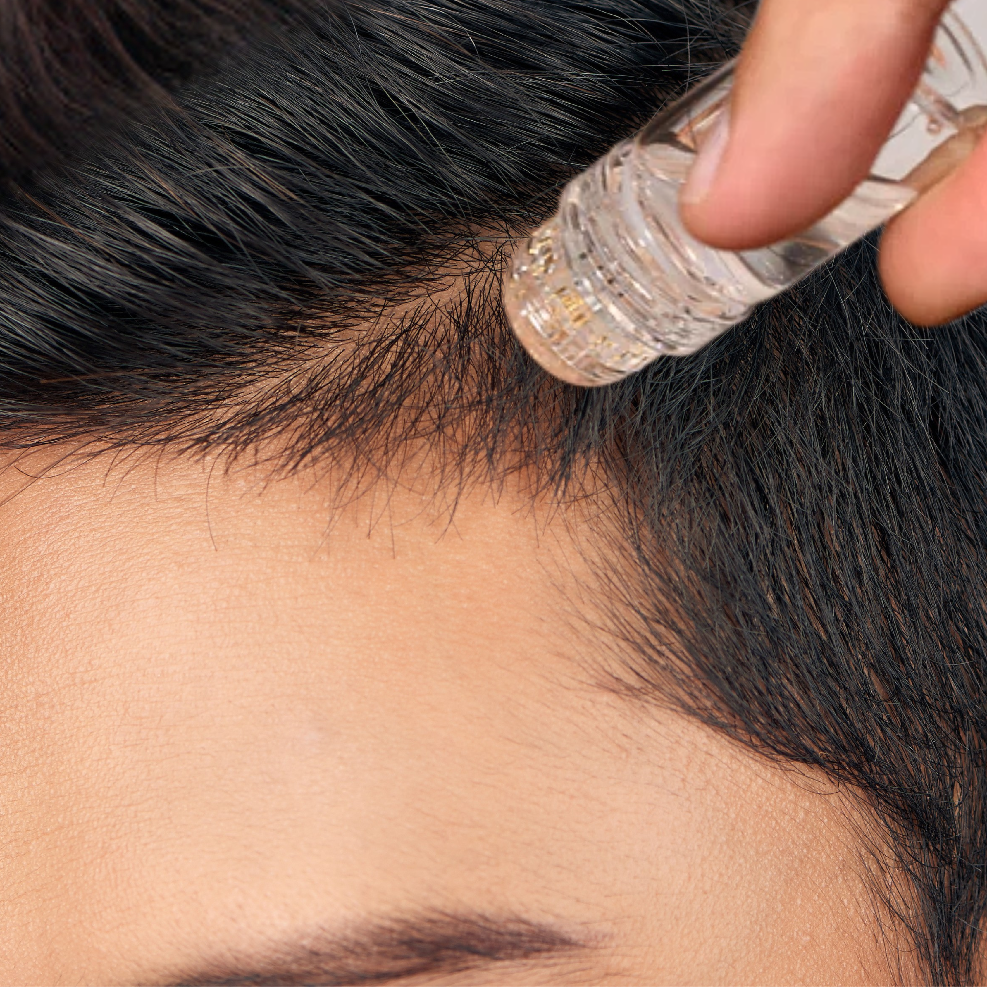 Follicly™ Serum Applicator - Microinfusion Titanium Needles