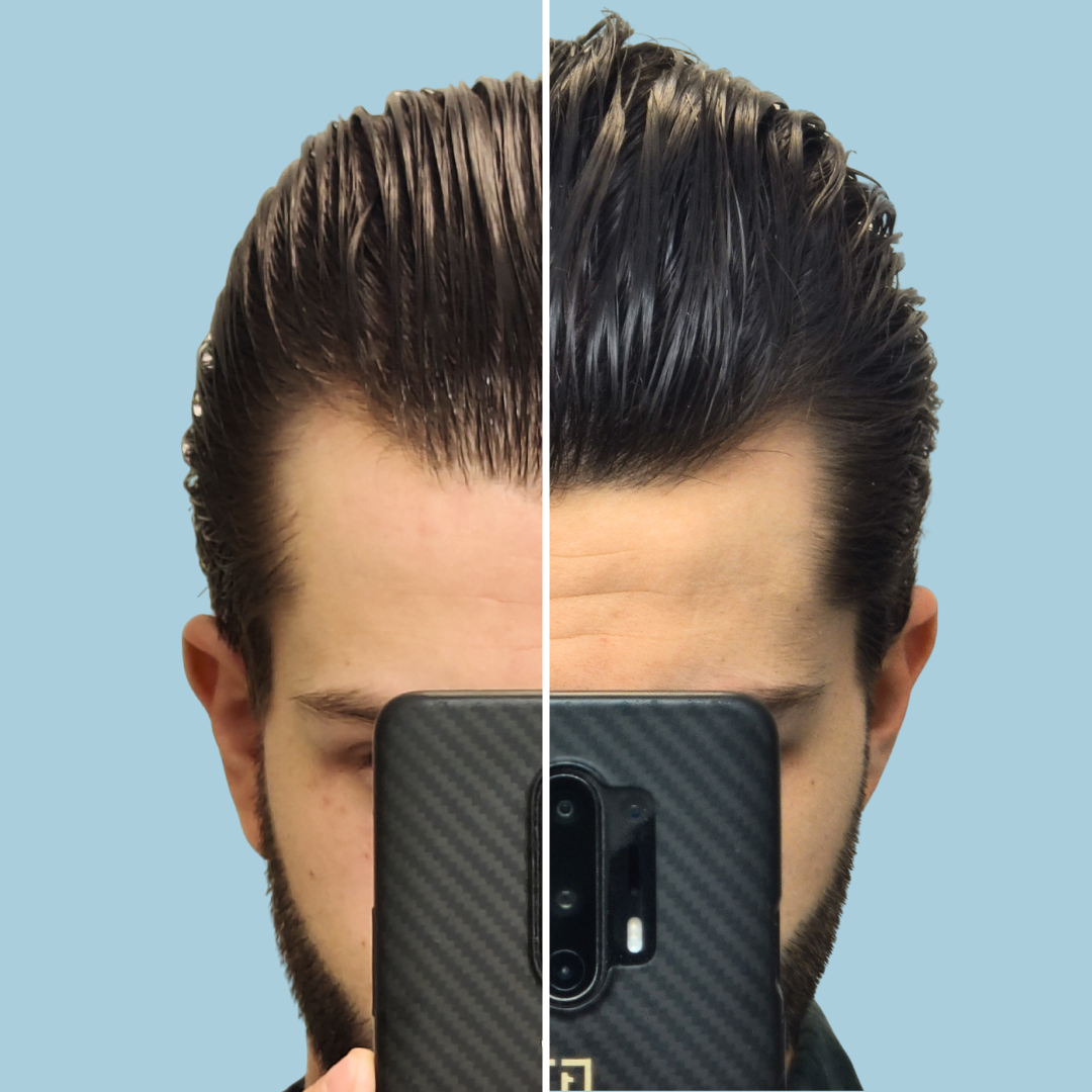 Follicly