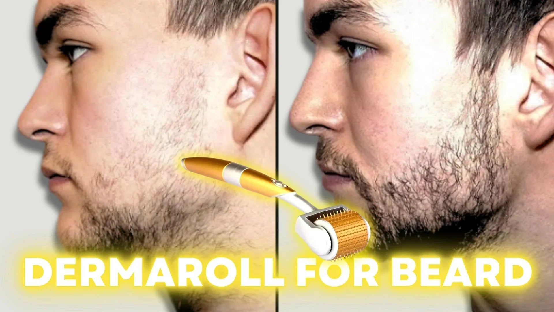 How to Derma Roll for Quickest Beard Results (Step-by-Step Guide)