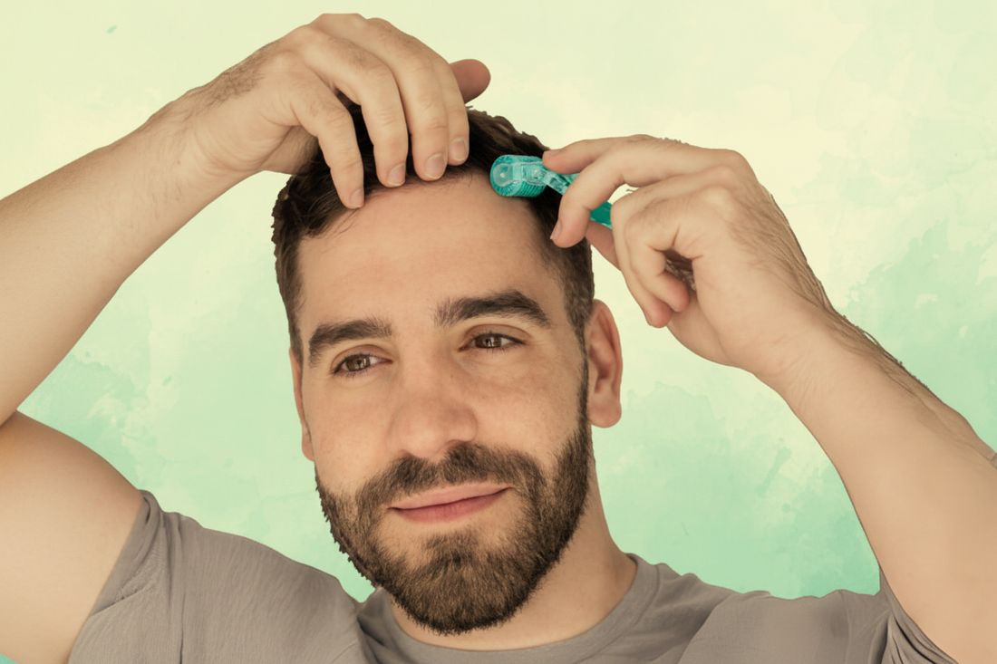 Why Is My Hair Still Falling Out After Microneedling?