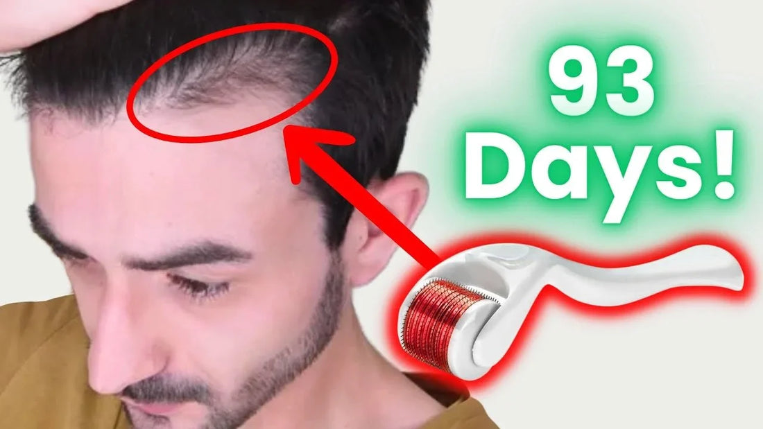 How to Get the QUICKEST Hair Growth with a Derma Roller